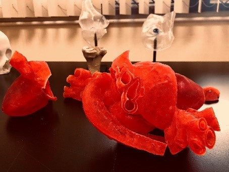3D-Printed Heart Model