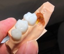 3D-Printed Dental Simulator for Education