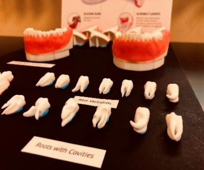 3D-Printed Dental Simulator for Education